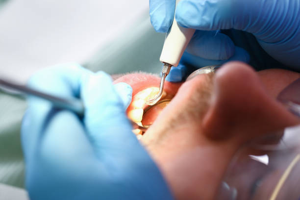 Best Urgent Care for Lost Fillings or Crowns in Winnsboro, LA